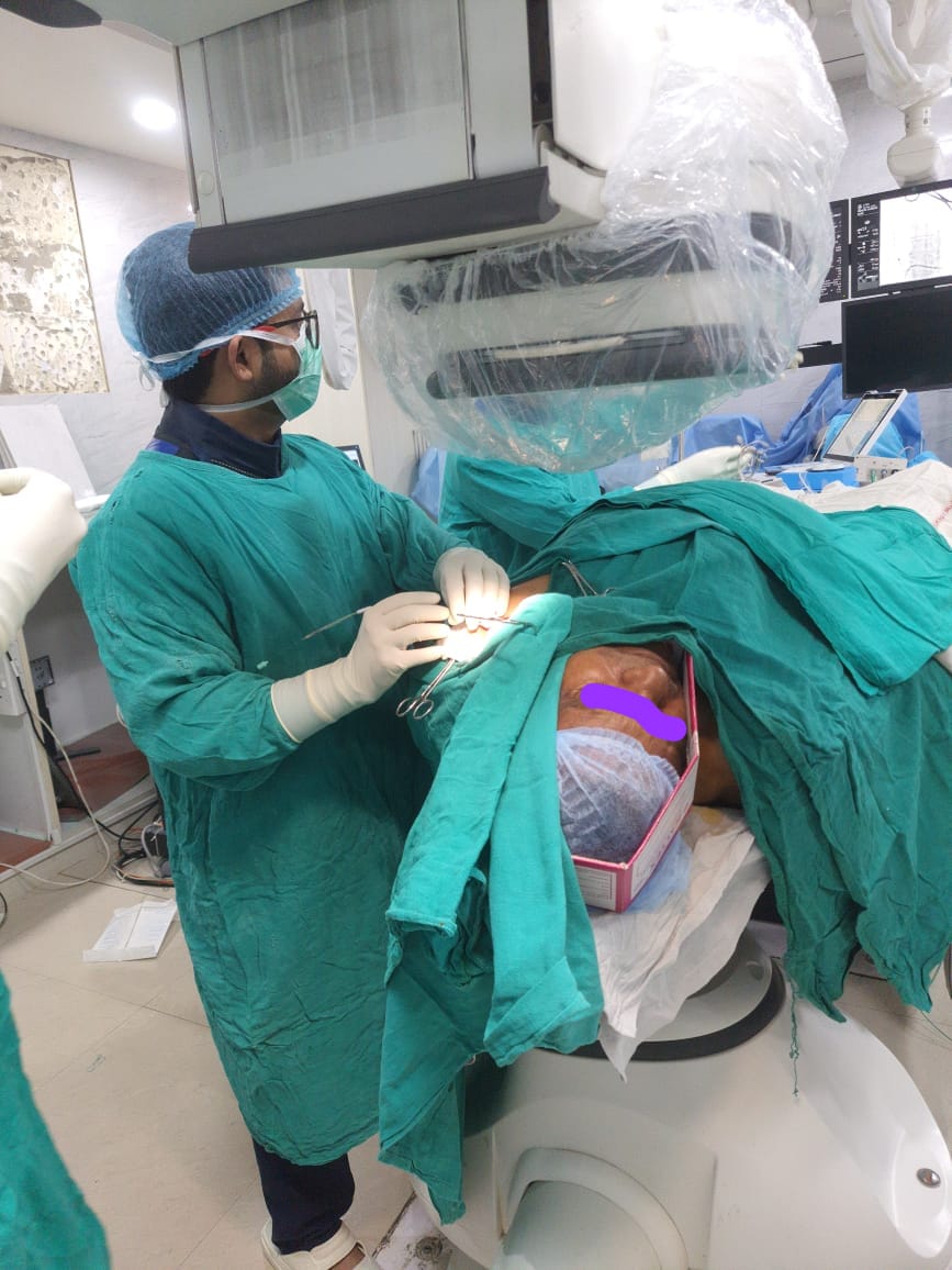 Pacemaker AICD Implantation in Ghaziabad