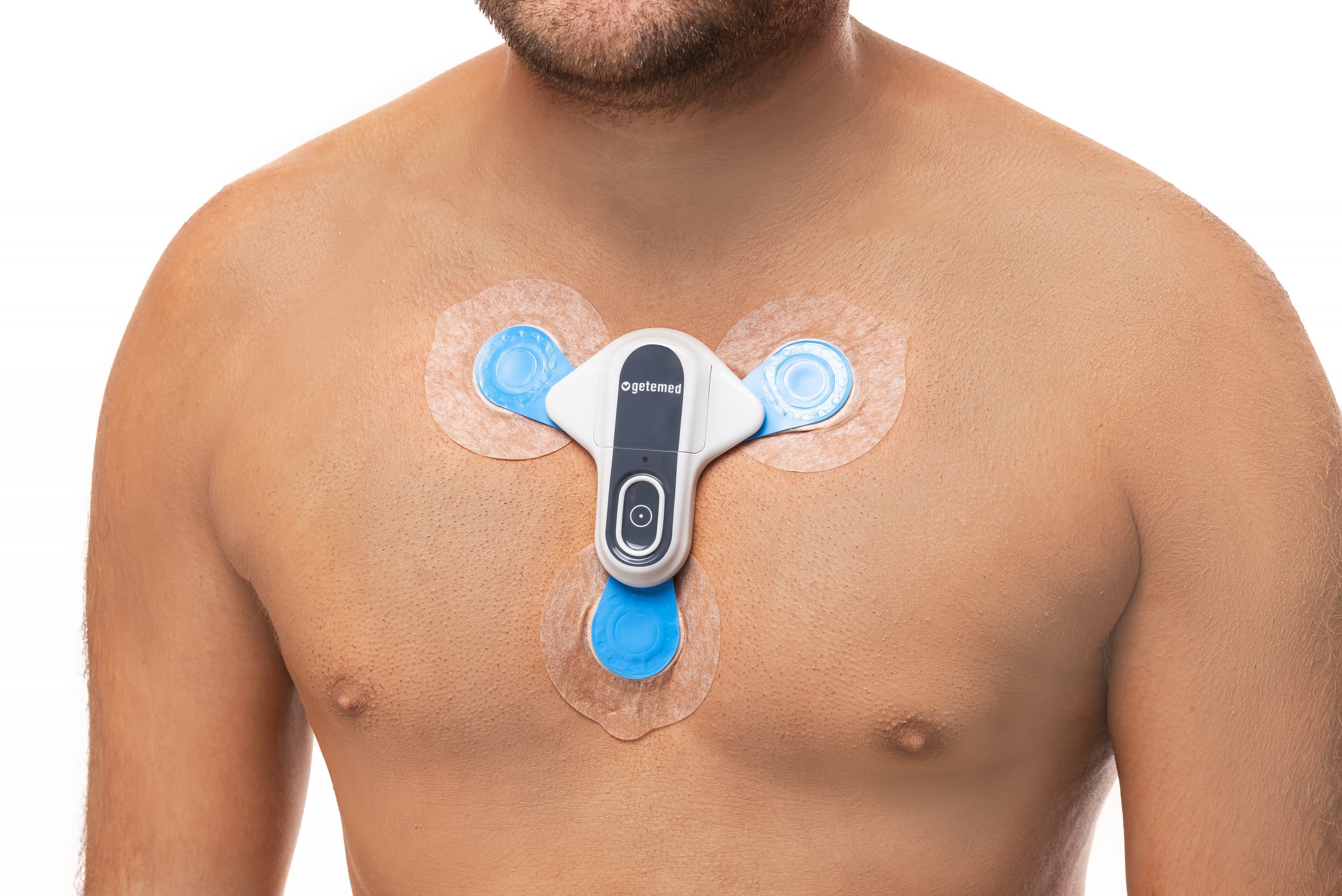 External Loop Recording